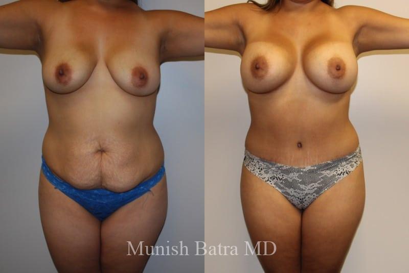 Before and After Image