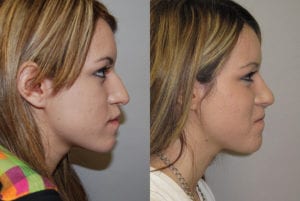 Before and After Image