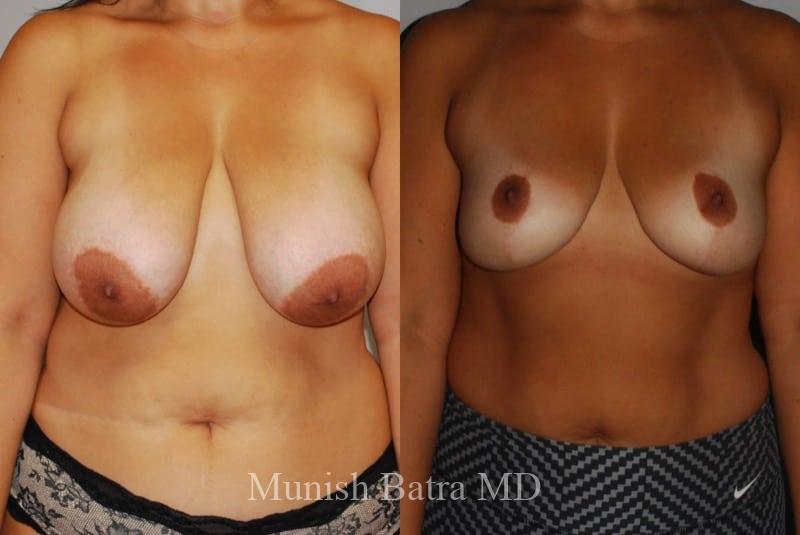 Before and After Image