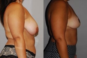 Before and After Image