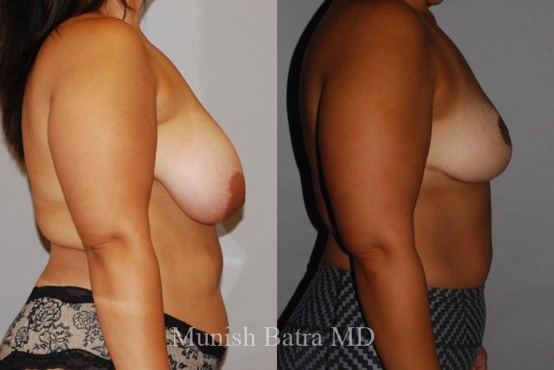 Before and After Image