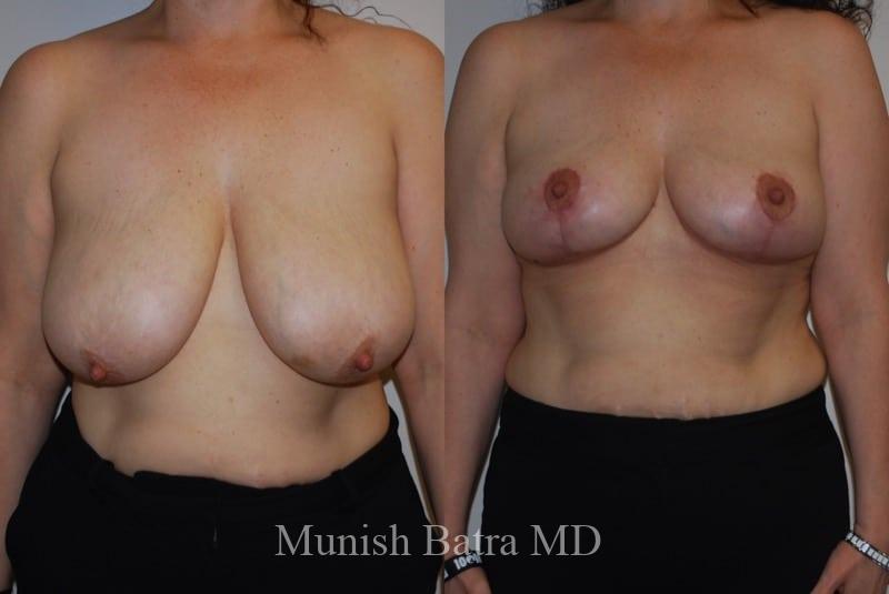 Before and After Image
