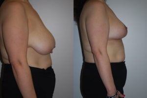 Before and After Image