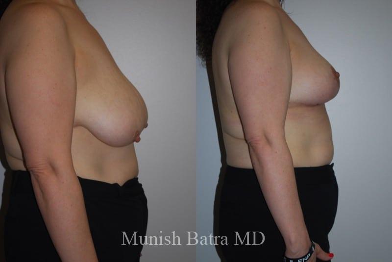 Before and After Image