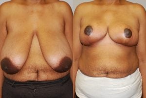 Before and After Image