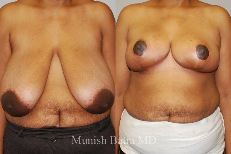 Before and After Image