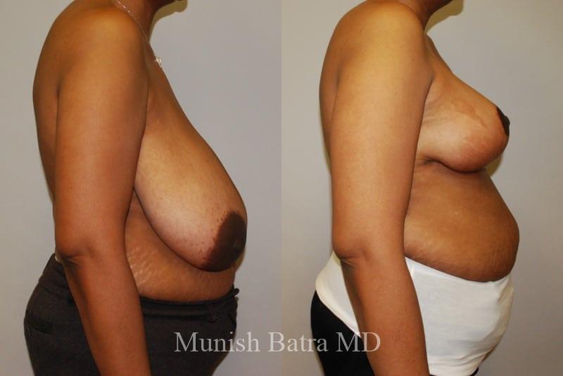 Before and After Image