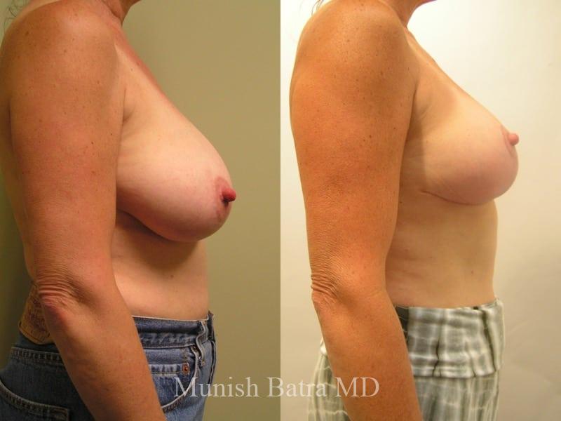 Before and After Image