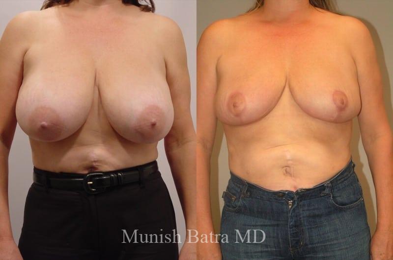 Before and After Image