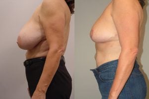 Before and After Image