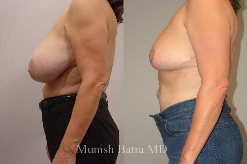 Before and After Image