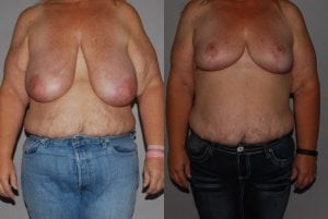 Before and After Image