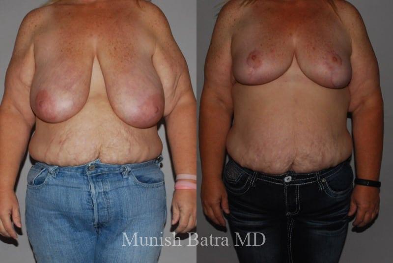 Before and After Image