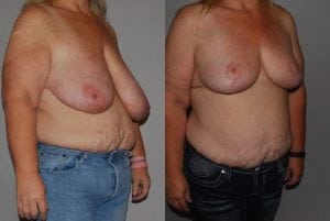 Before and After Image