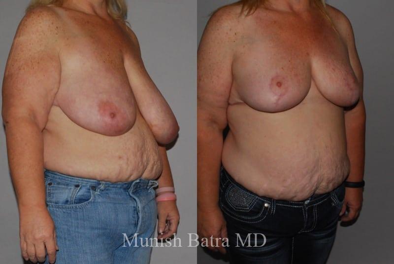 Before and After Image