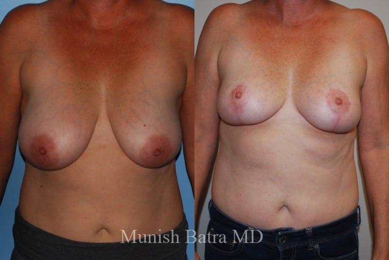 Before and After Image