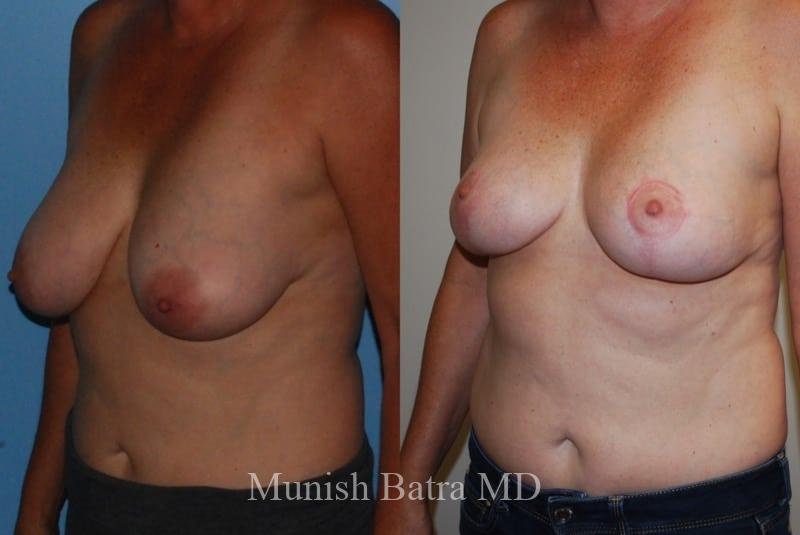 Before and After Image
