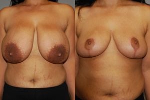 Before and After Image