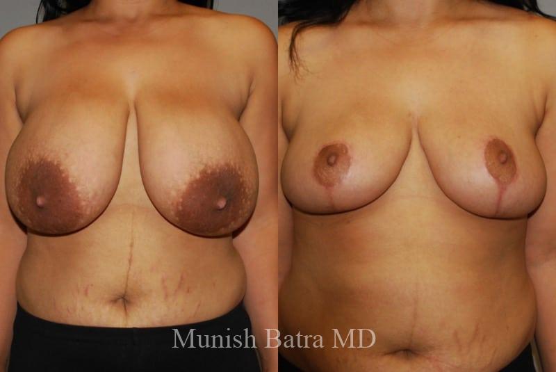 Before and After Image