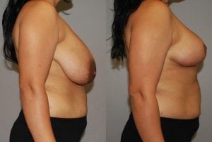 Before and After Image
