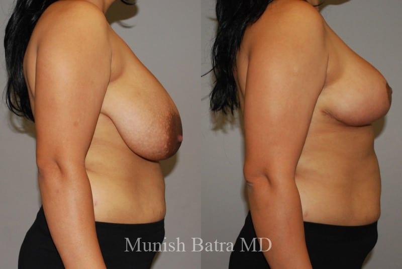 Before and After Image