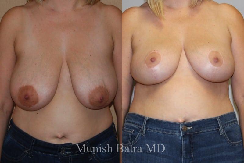 Before and After Image