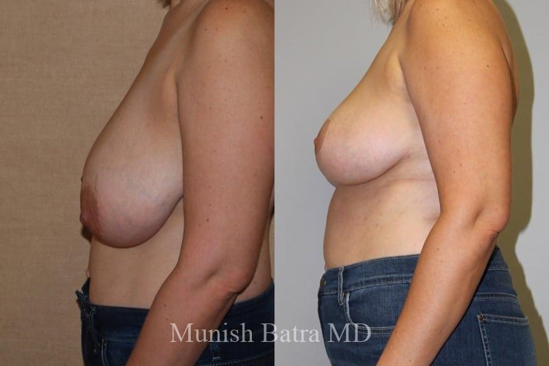 Before and After Image