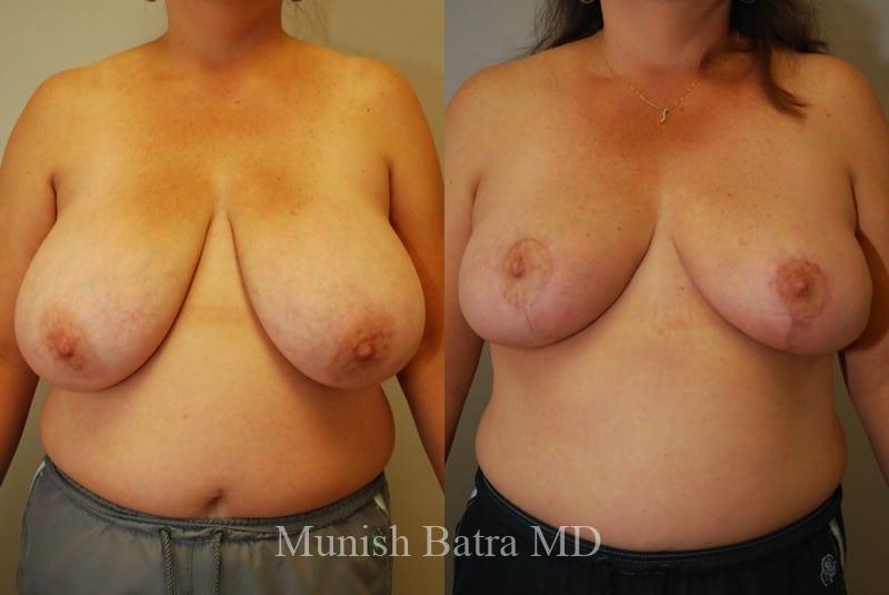 Before and After Image