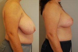Before and After Image
