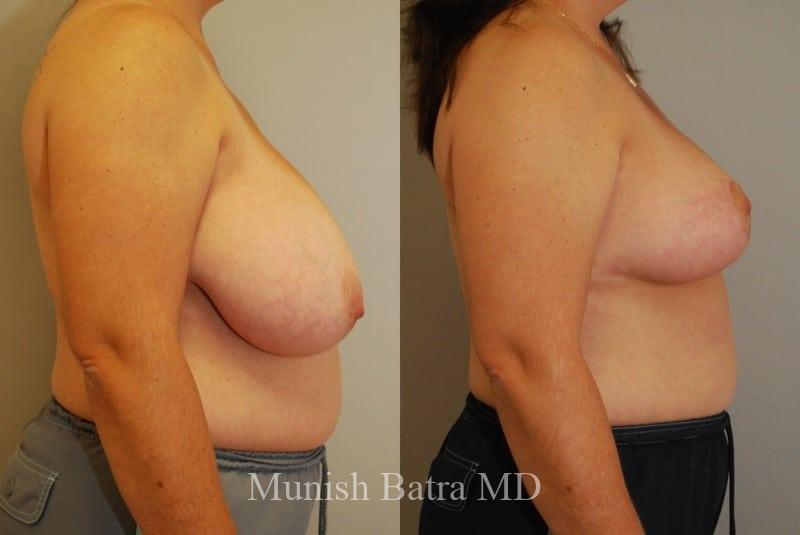 Before and After Image