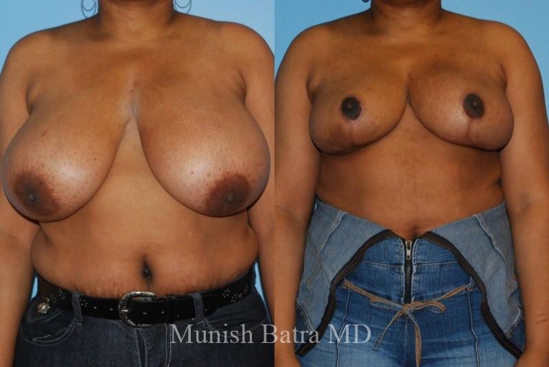 Before and After Image