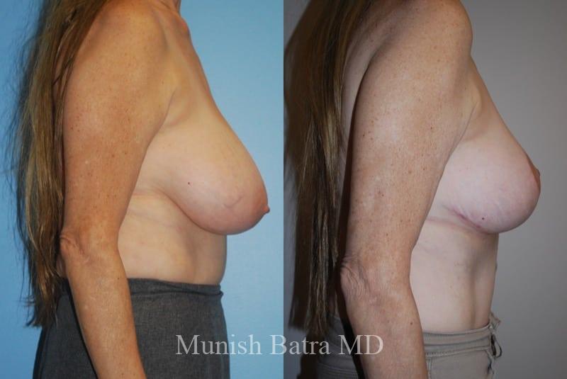 Before and After Image