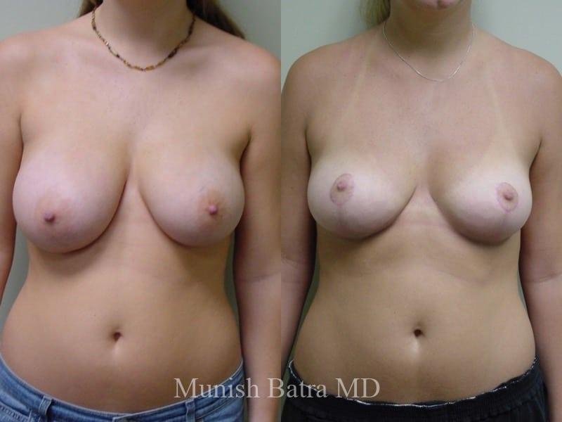 Before and After Image