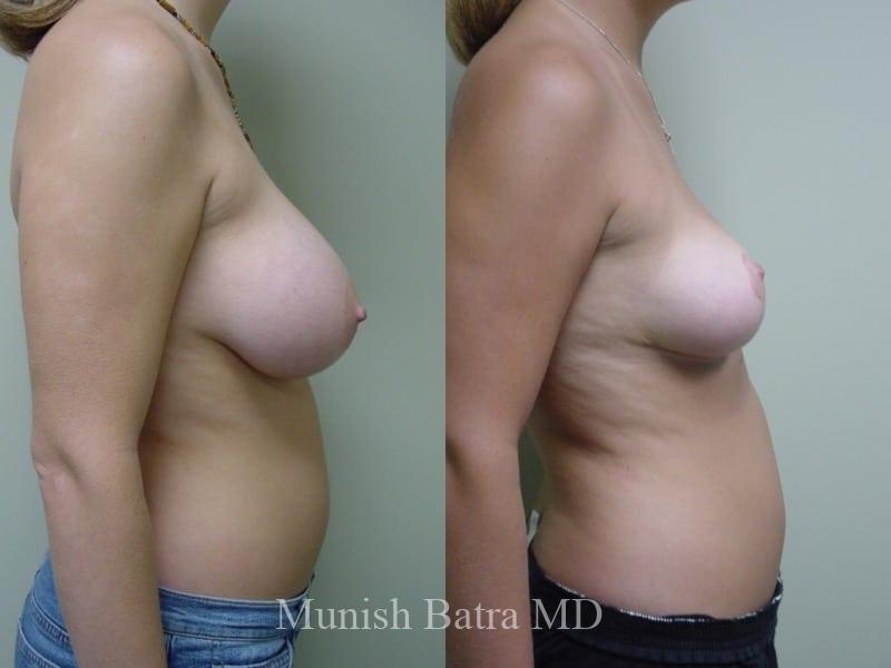 Before and After Image