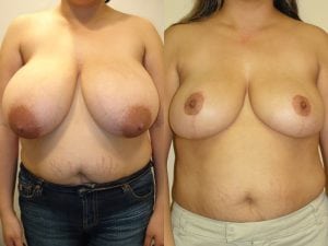 Before and After Image