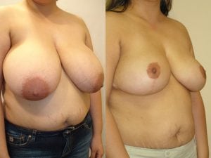 Before and After Image