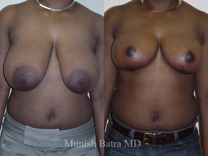 Before and After Image