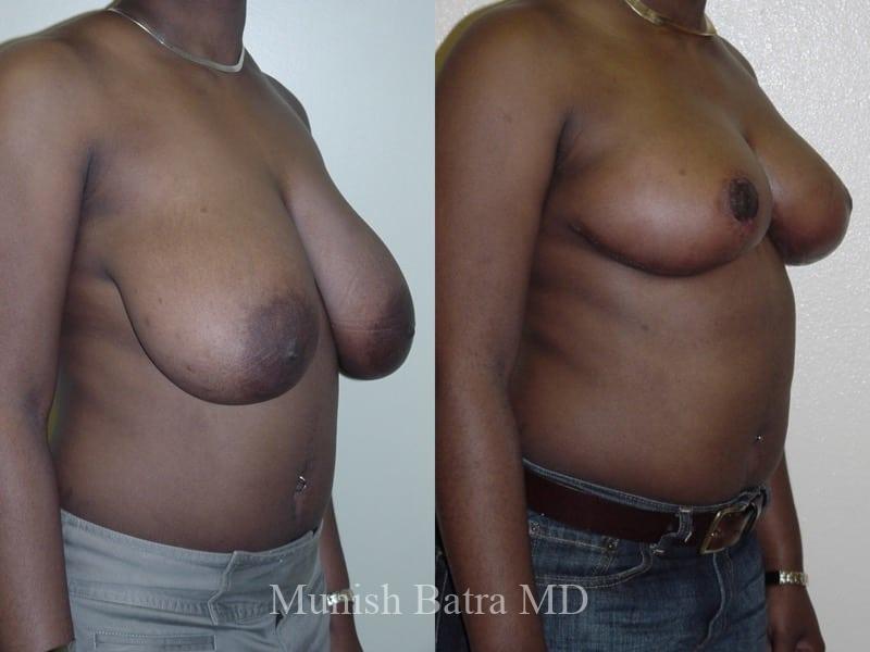 Before and After Image