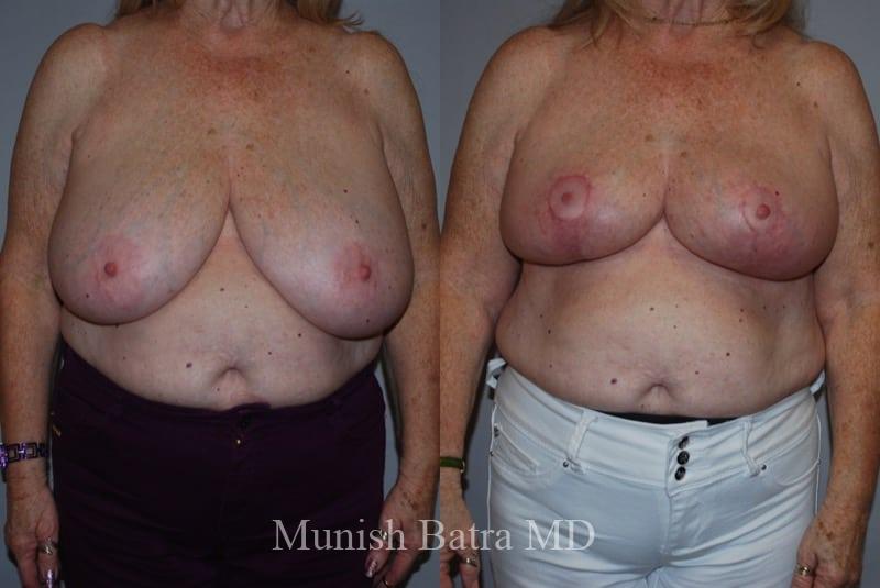 Before and After Image