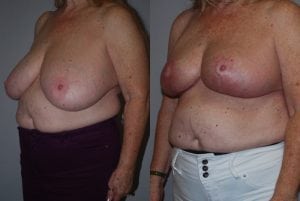 Before and After Image