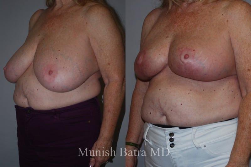 Before and After Image