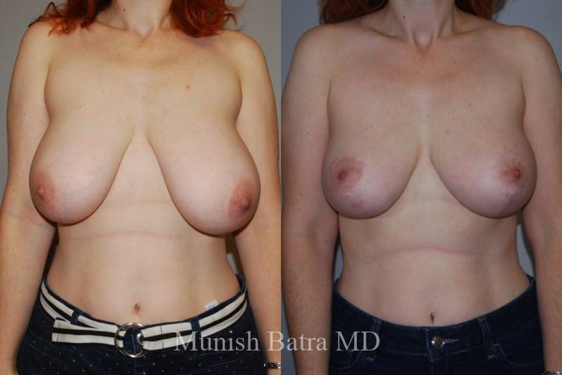 Before and After Image