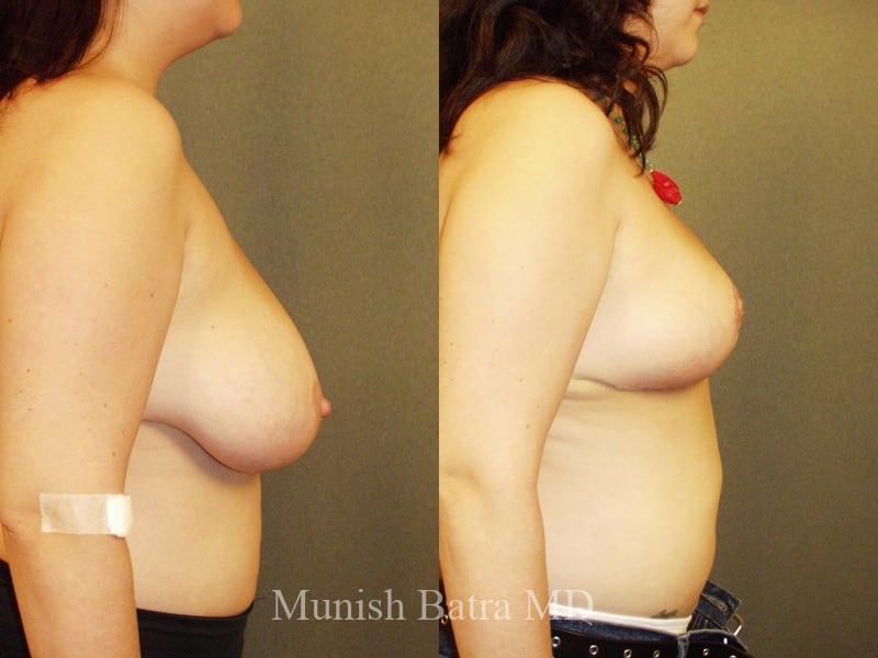 Before and After Image