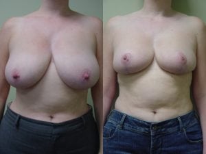 Before and After Image