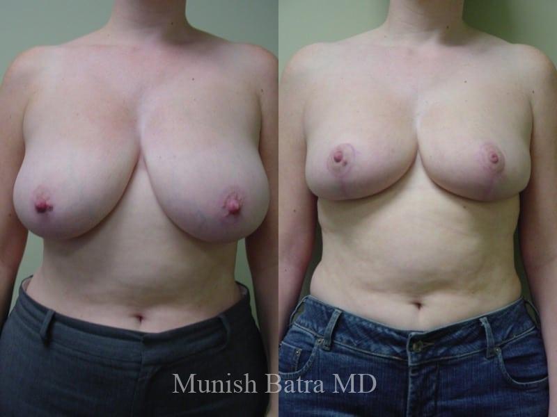 Before and After Image