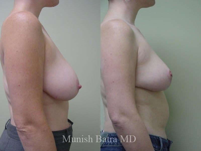 Before and After Image