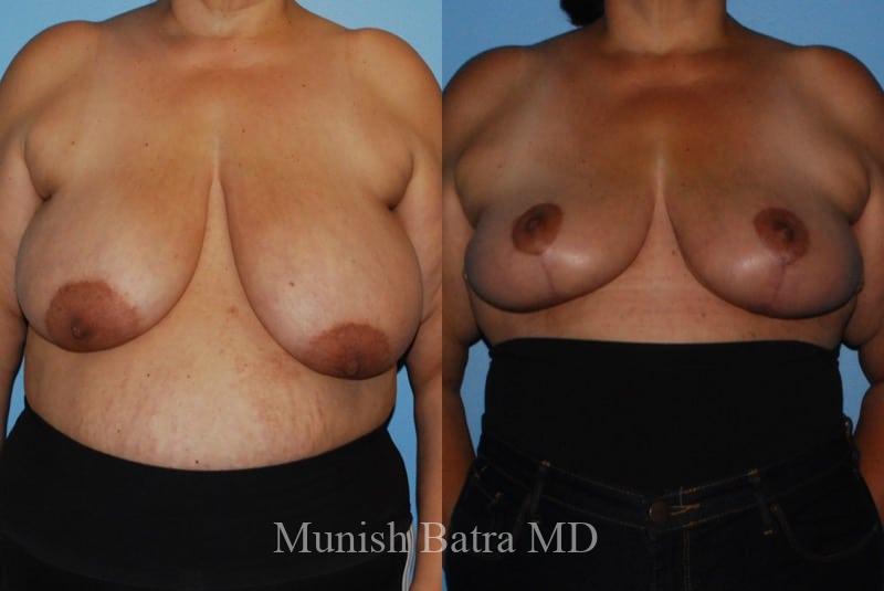 Before and After Image