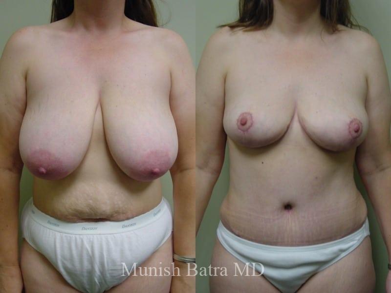 Before and After Image