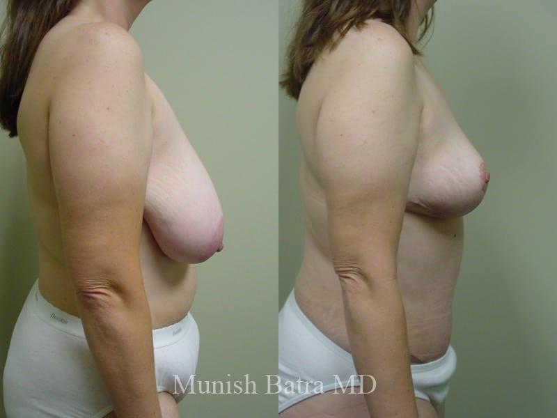Before and After Image