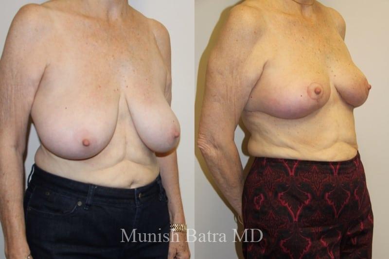 Before and After Image